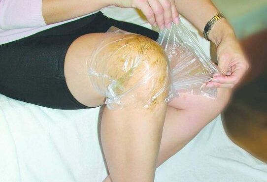 compresse sur le genou pour l'arthrose