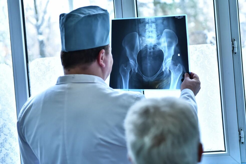 Le médecin regarde une photo d’une articulation de la hanche souffrant d’arthrose